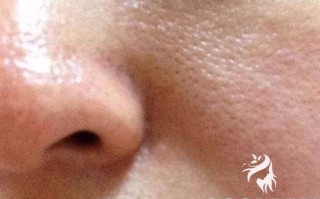 “毛孔粗大怎么办？7个护肤细节教你拯救毛孔