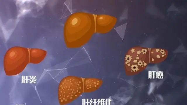 肝脏运动_肝功能运动_做什么运动对肝脏好