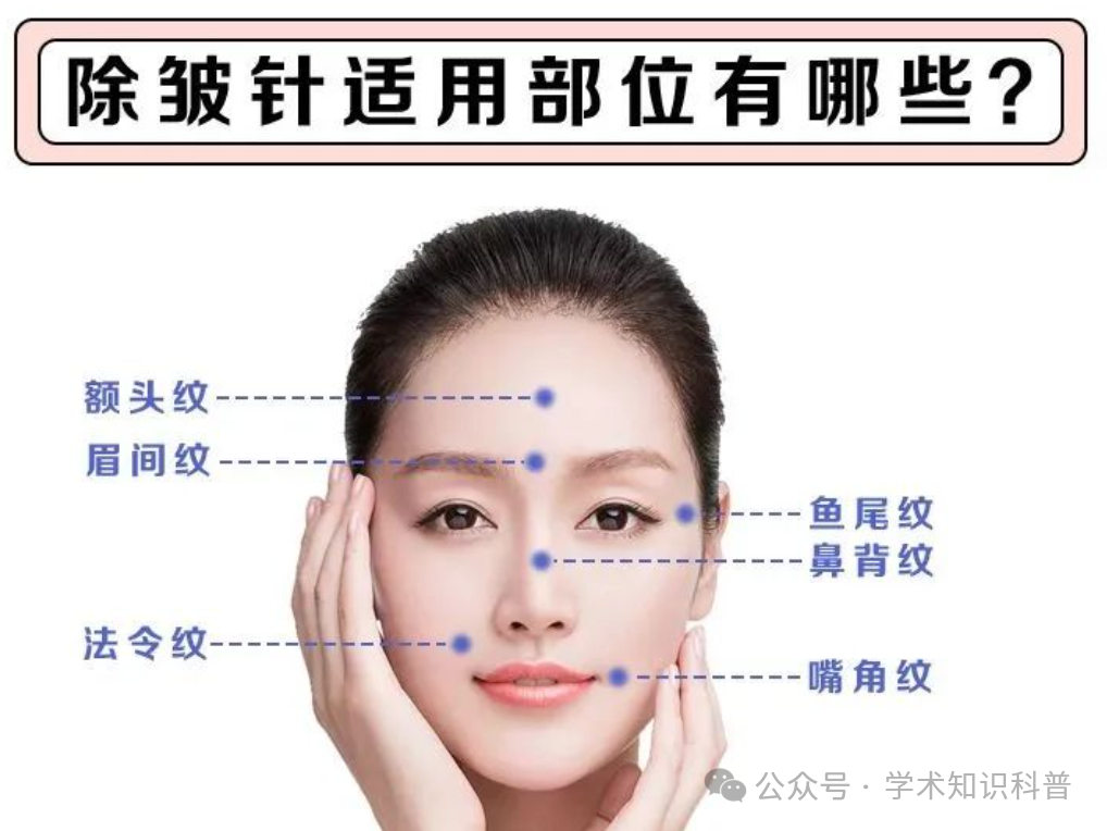 电波拉皮除皱会不会有副作用_电波拉皮和除皱针哪个效果好_电波拉皮除皱价格